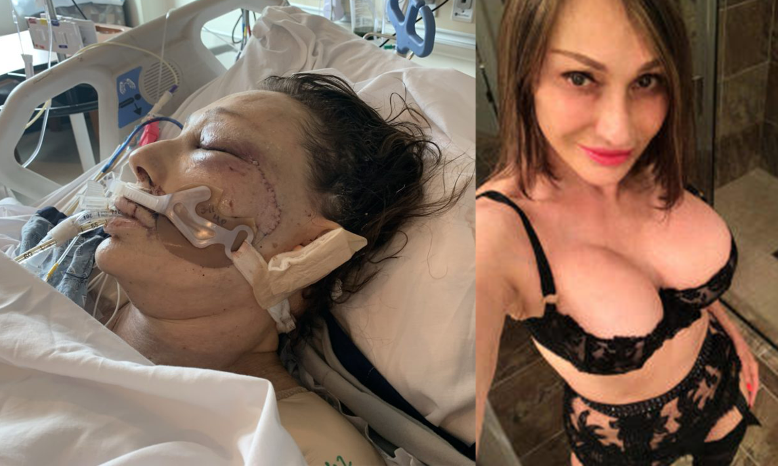 GoFundMe Set Up for Jillian Foxxx After Assault in Home