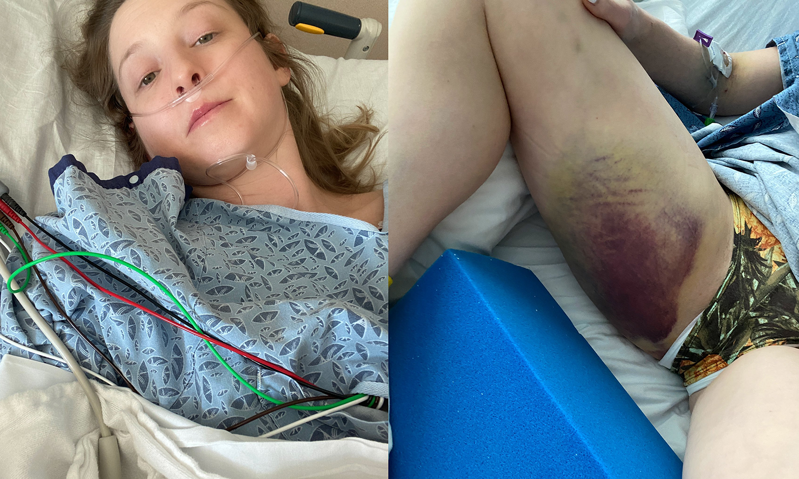 Sunny Lane Back to Work After Recovery From Motorcycle Accident