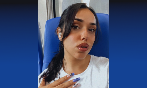 Euro Star Esperanza Del Horno Appeals for Help With GoFundMe