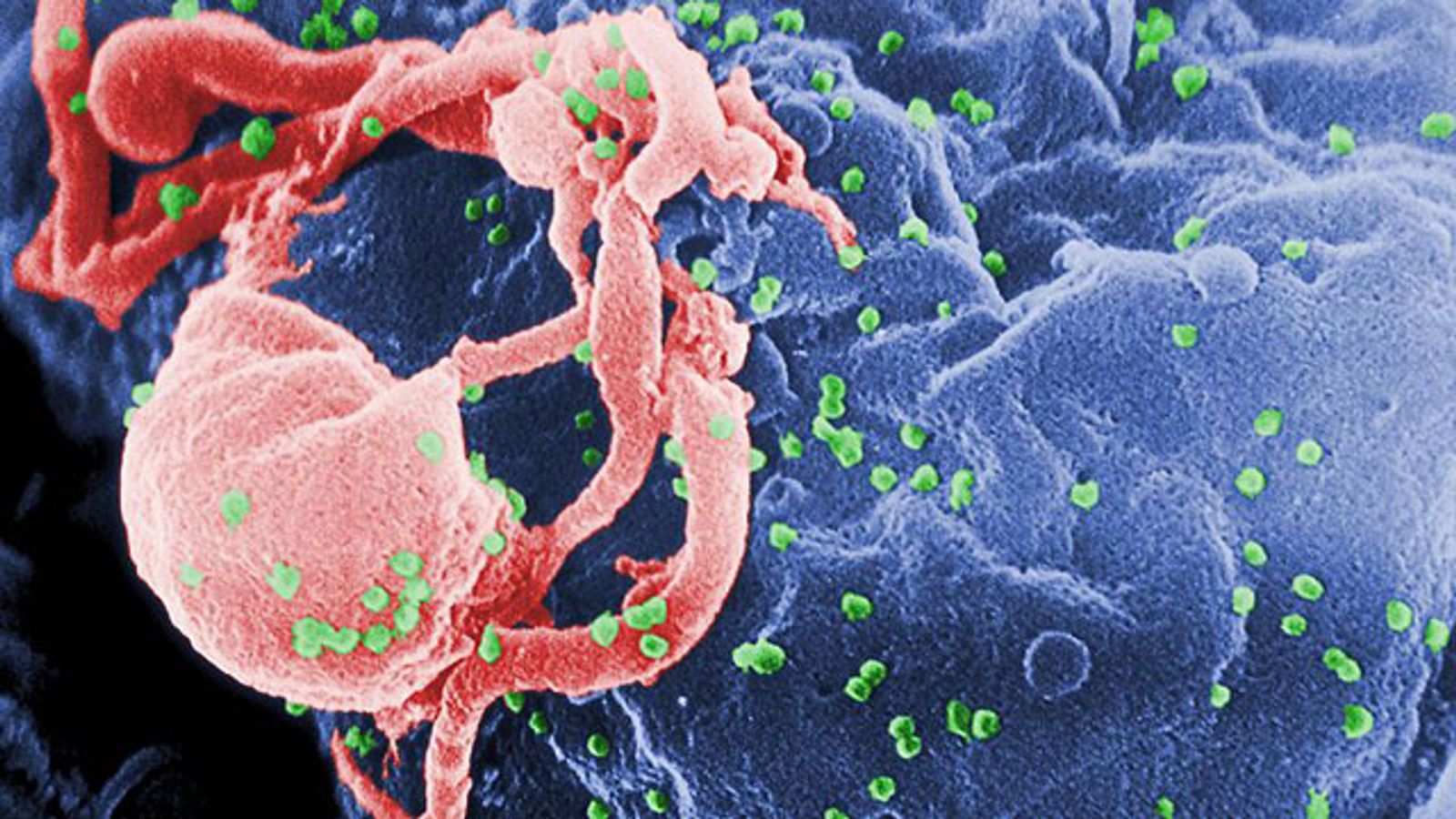 FDA Panel Recommends Over-the-Counter At-Home HIV Test