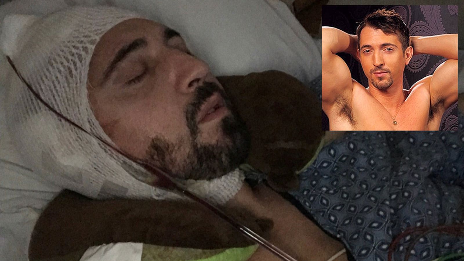 GoFundMe Campaign Created For Injured Gay Star Jimmy Durano
