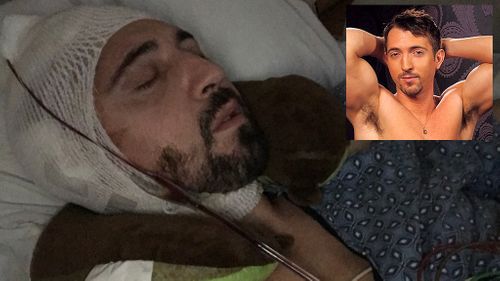 GoFundMe Campaign Created For Injured Gay Star Jimmy Durano