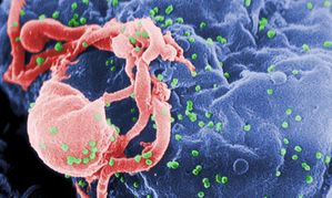 2nd HIV Patient Reportedly Clear of Virus After Stem Cell Therapy