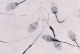 BBC to Broadcast First Sperm Race